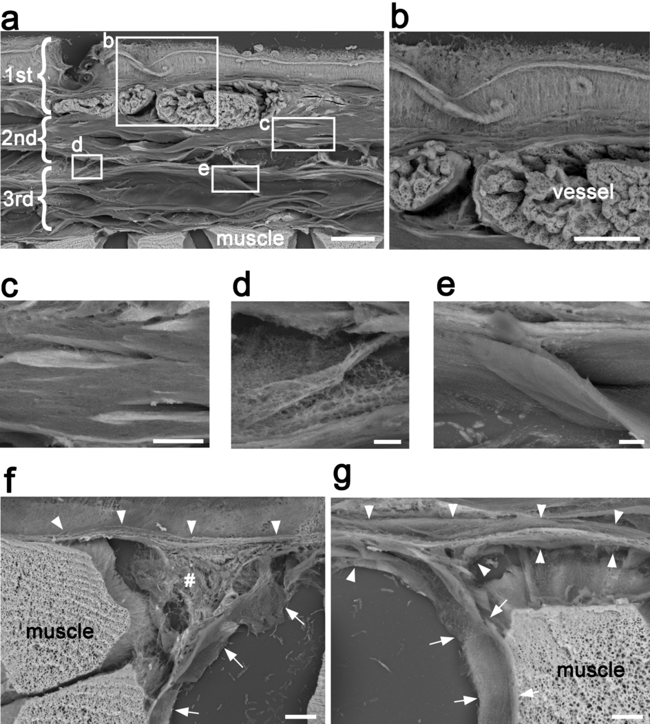 Microscopie électronique du fascia profond : couches de collagène et réseau fibreux fin, particulièrement visible dans le panneau d